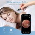 Інструменти для видалення вушної сірки VITCOCO (R-3208) Інструменти для видалення вушної сірки VITCOCO (R-3208)